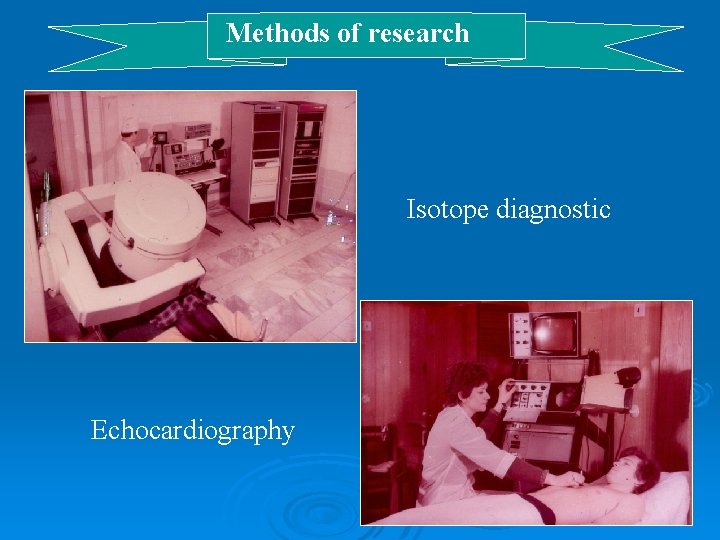 Methods of research Isotope diagnostic Echocardiography 