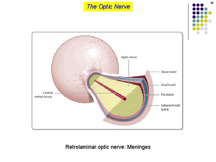 The Optic Nerve Retrolaminar optic nerve: Meninges 95 
