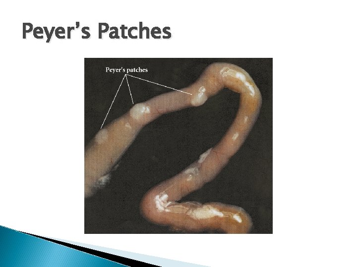 Peyer’s Patches 