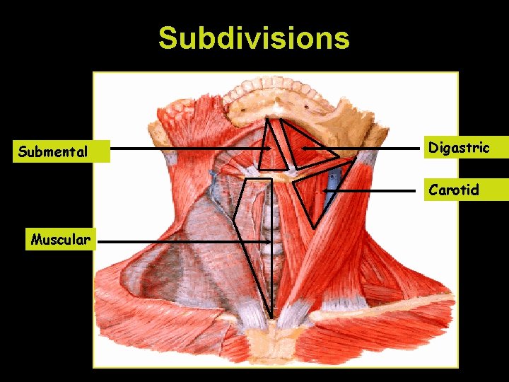 Subdivisions Submental Digastric Carotid Muscular 