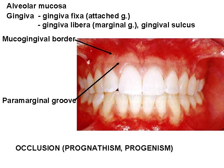 Alveolar mucosa Gingiva - gingiva fixa (attached g. ) - gingiva libera (marginal g.