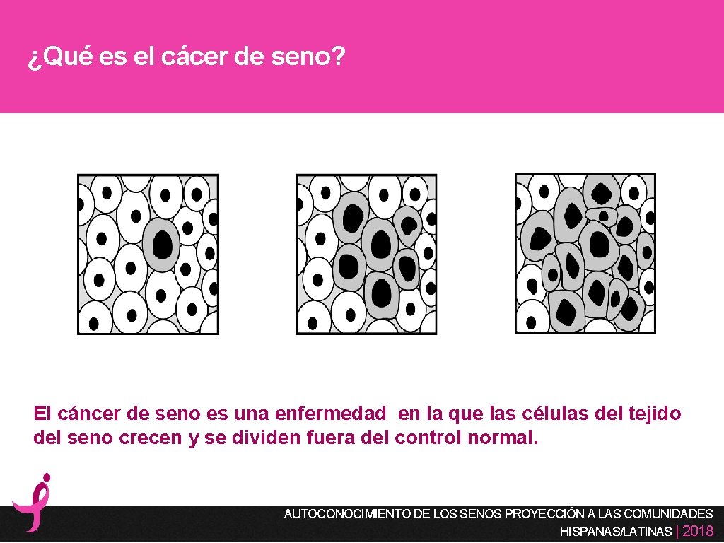 ¿Qué es el cácer de seno? El cáncer de seno es una enfermedad en