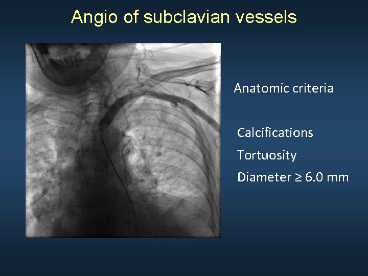 Angio of subclavian vessels Anatomic criteria Calcifications Tortuosity Diameter ≥ 6. 0 mm 