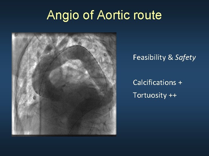 Angio of Aortic route Feasibility & Safety Calcifications + Tortuosity ++ 