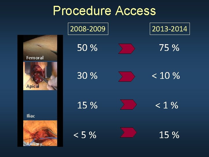 Procedure Access 2008 -2009 2013 -2014 50 % 75 % 30 % < 10