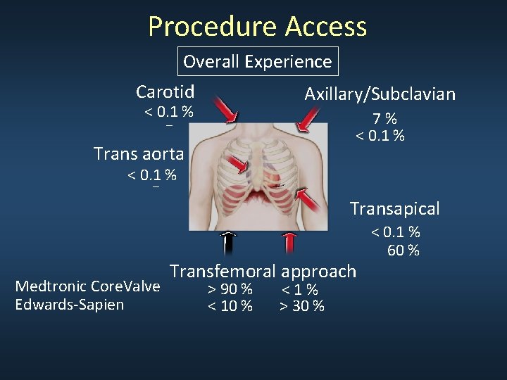 Procedure Access Overall Experience Carotid Axillary/Subclavian < 0. 1 % _ 7% < 0. Procedure Access Overall Experience Carotid Axillary/Subclavian < 0. 1 % _ 7% < 0.