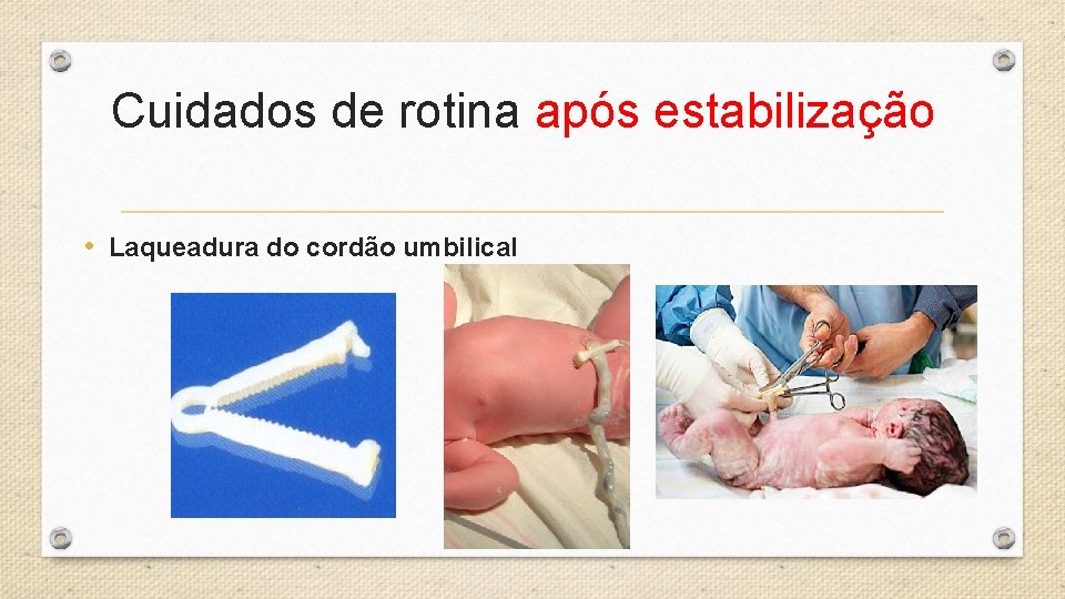 Cuidados de rotina após estabilização • Laqueadura do cordão umbilical 