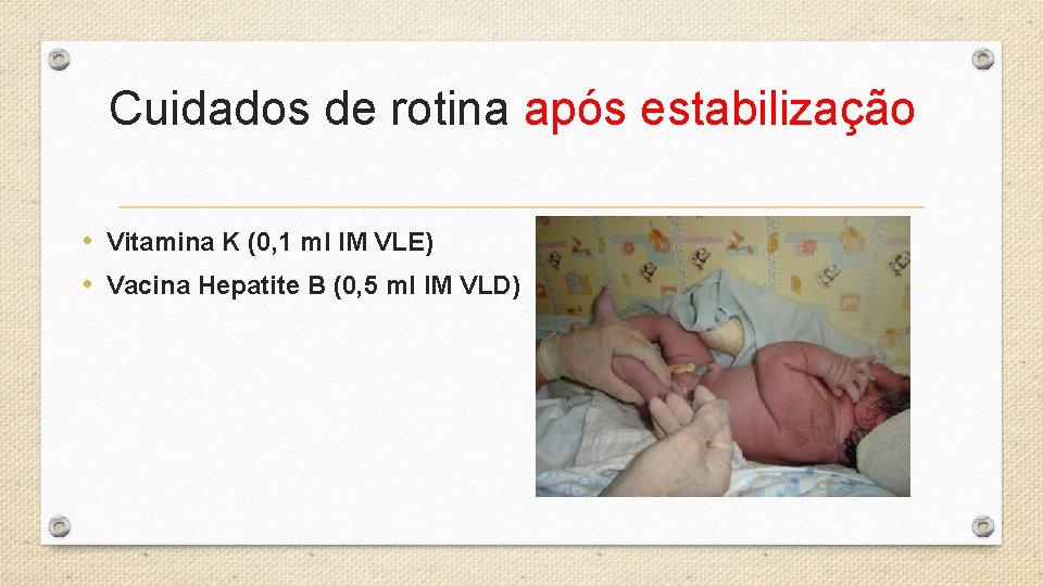 Cuidados de rotina após estabilização • Vitamina K (0, 1 ml IM VLE) •