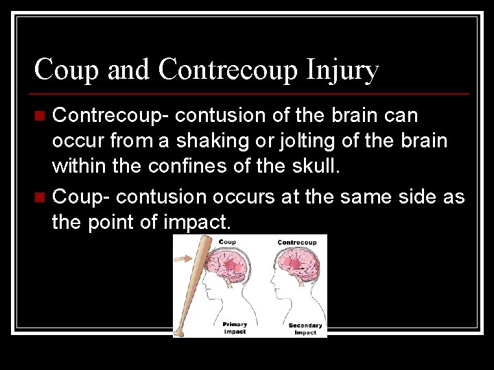 Coup and Contrecoup Injury Contrecoup- contusion of the brain can occur from a shaking