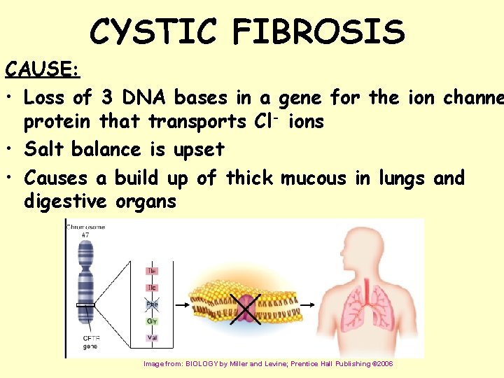 CYSTIC FIBROSIS CAUSE: • Loss of 3 DNA bases in a gene for the