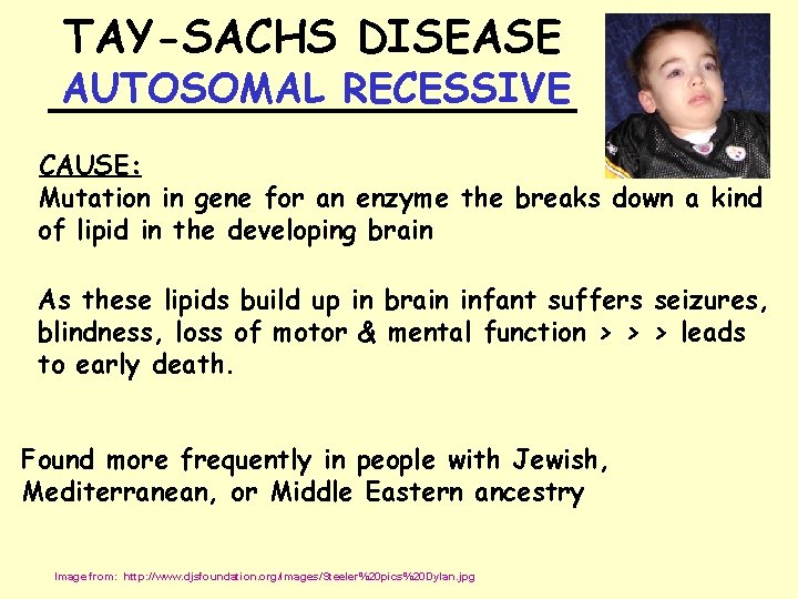 TAY-SACHS DISEASE AUTOSOMAL RECESSIVE __________ CAUSE: Mutation in gene for an enzyme the breaks