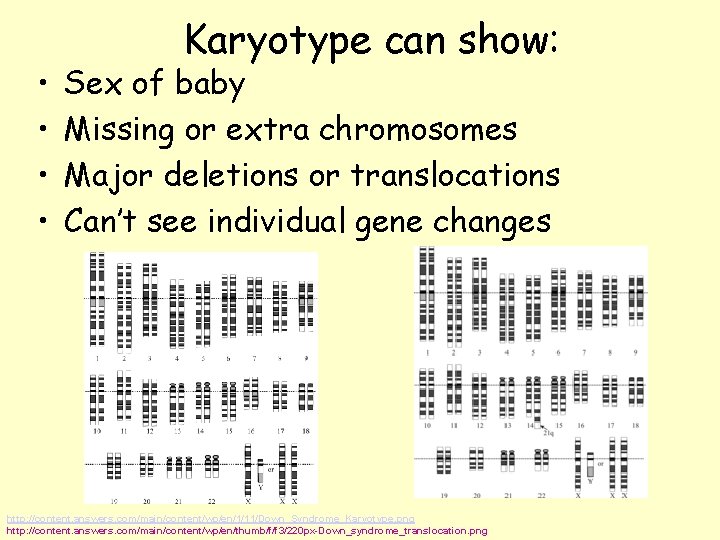  • • Karyotype can show: Sex of baby Missing or extra chromosomes Major