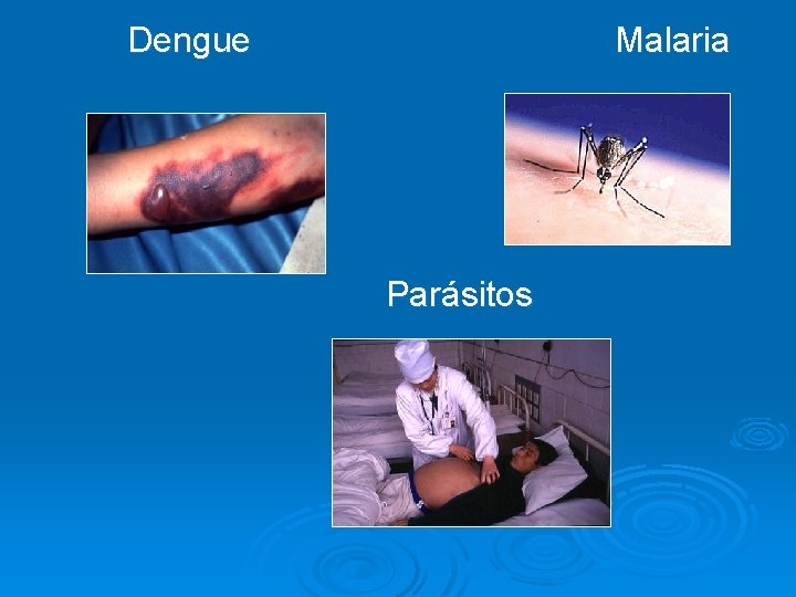  Dengue Malaria Parásitos 