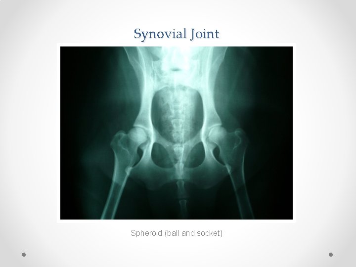 Synovial Joint Spheroid (ball and socket) 