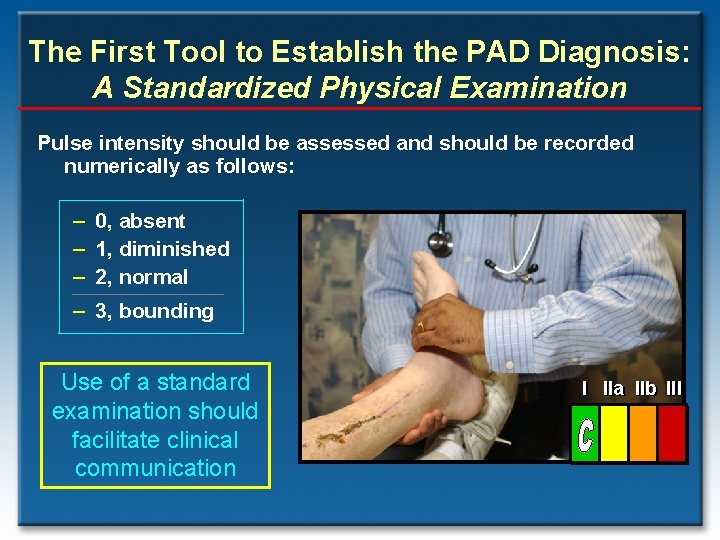 The First Tool to Establish the PAD Diagnosis: A Standardized Physical Examination Pulse intensity