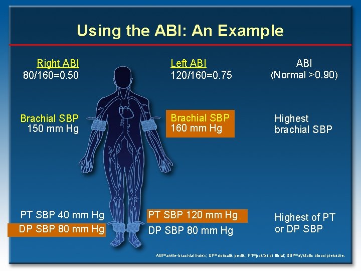 Using the ABI: An Example Right ABI 80/160=0. 50 Left ABI 120/160=0. 75 ABI