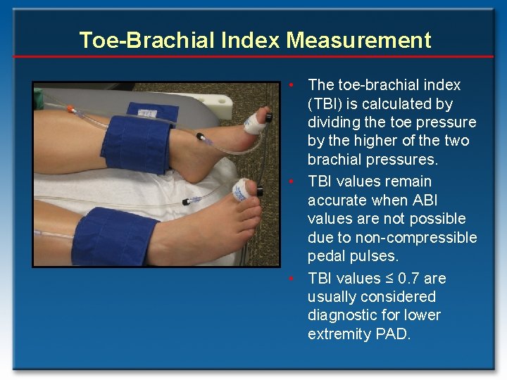 Toe-Brachial Index Measurement • The toe-brachial index (TBI) is calculated by dividing the toe