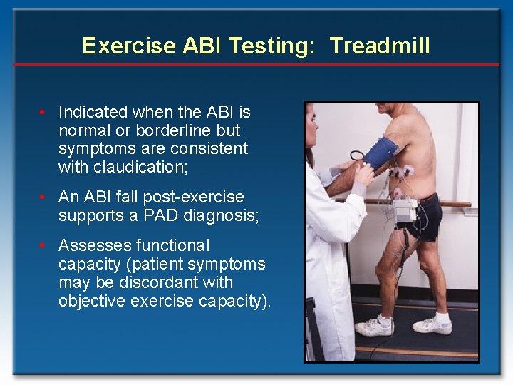 Exercise ABI Testing: Treadmill • Indicated when the ABI is normal or borderline but