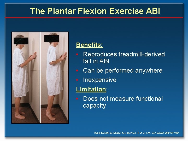 The Plantar Flexion Exercise ABI Benefits: • Reproduces treadmill-derived fall in ABI • Can