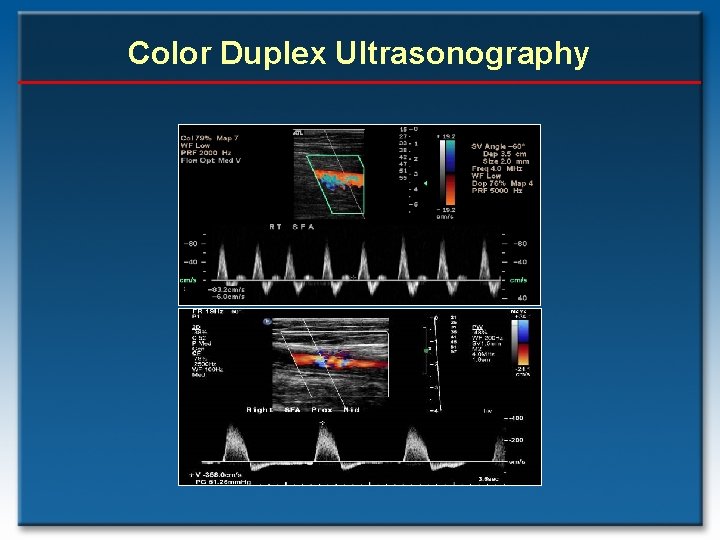 Color Duplex Ultrasonography 