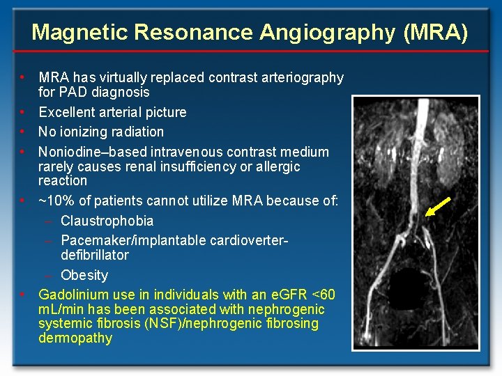 Magnetic Resonance Angiography (MRA) • MRA has virtually replaced contrast arteriography for PAD diagnosis