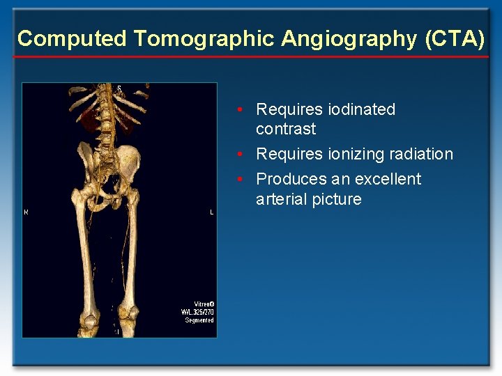 Computed Tomographic Angiography (CTA) • Requires iodinated contrast • Requires ionizing radiation • Produces