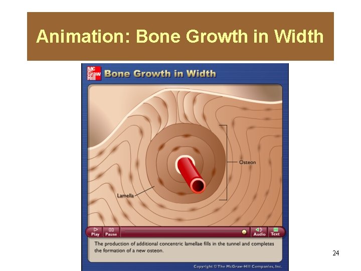Animation: Bone Growth in Width Please note that due to differing operating systems, some
