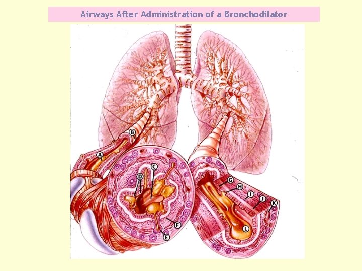 Airways After Administration of a Bronchodilator 