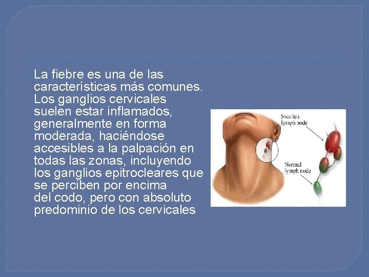 � La fiebre es una de las características más comunes. Los ganglios cervicales suelen � La fiebre es una de las características más comunes. Los ganglios cervicales suelen
