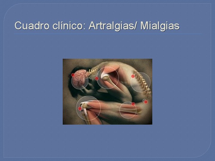Cuadro clínico: Artralgias/ Mialgias Cuadro clínico: Artralgias/ Mialgias