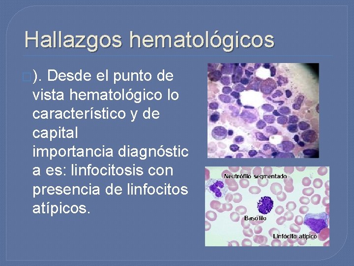 Hallazgos hematológicos �). Desde el punto de vista hematológico lo característico y de capital Hallazgos hematológicos �). Desde el punto de vista hematológico lo característico y de capital