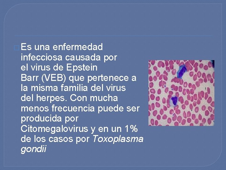 � Es una enfermedad infecciosa causada por el virus de Epstein Barr (VEB) que � Es una enfermedad infecciosa causada por el virus de Epstein Barr (VEB) que