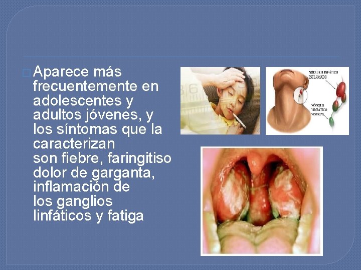 � Aparece más frecuentemente en adolescentes y adultos jóvenes, y los síntomas que la � Aparece más frecuentemente en adolescentes y adultos jóvenes, y los síntomas que la