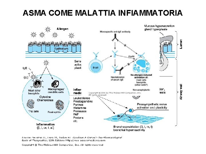 ASMA COME MALATTIA INFIAMMATORIA 