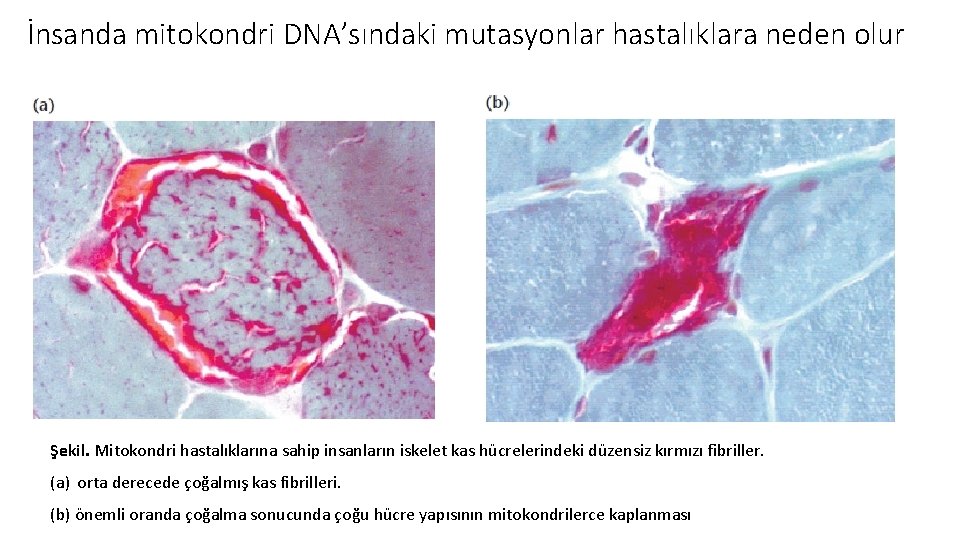 İnsanda mitokondri DNA’sındaki mutasyonlar hastalıklara neden olur Şekil. Mitokondri hastalıklarına sahip insanların iskelet kas