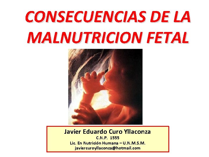 CONSECUENCIAS DE LA MALNUTRICION FETAL Javier Eduardo Curo Yllaconza C. N. P. 1555 Lic. CONSECUENCIAS DE LA MALNUTRICION FETAL Javier Eduardo Curo Yllaconza C. N. P. 1555 Lic.