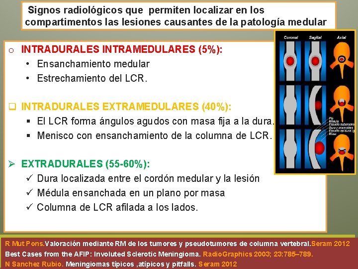 Signos radiológicos que permiten localizar en los compartimentos las lesiones causantes de la patología