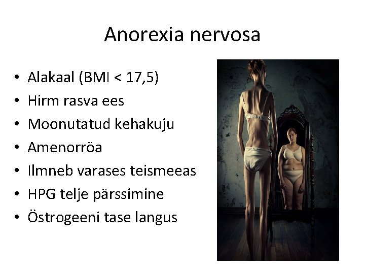 Anorexia nervosa • • Alakaal (BMI < 17, 5) Hirm rasva ees Moonutatud kehakuju