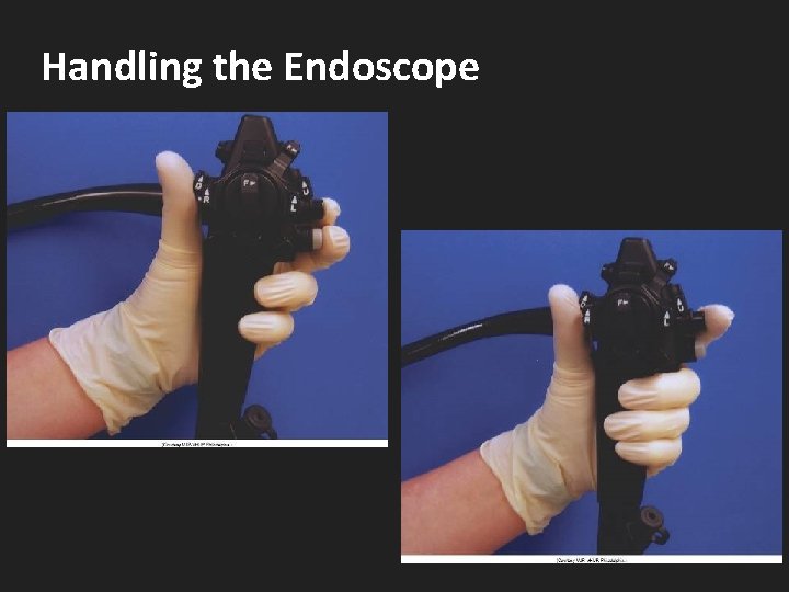 Handling the Endoscope 