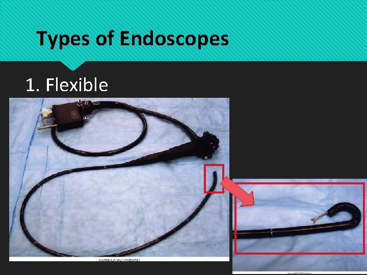 Types of Endoscopes 1. Flexible 
