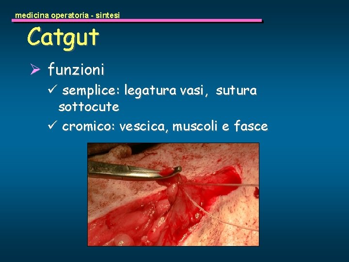 medicina operatoria - sintesi Catgut Ø funzioni ü semplice: legatura vasi, sutura sottocute ü