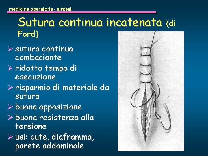 medicina operatoria - sintesi Sutura continua incatenata (di Ford) Ø sutura continua combaciante Ø