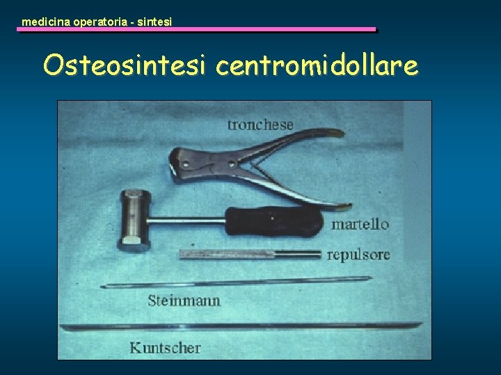 medicina operatoria - sintesi Osteosintesi centromidollare 