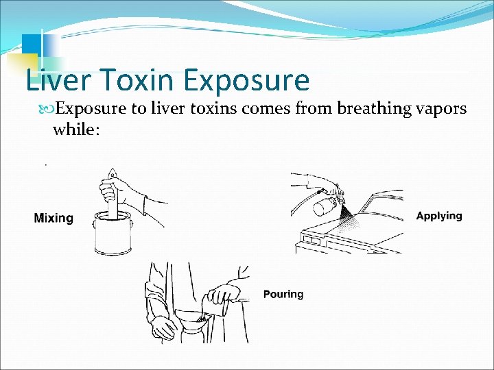 Liver Toxin Exposure to liver toxins comes from breathing vapors while: 