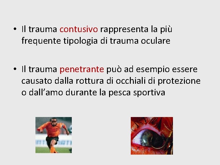  • Il trauma contusivo rappresenta la più frequente tipologia di trauma oculare •