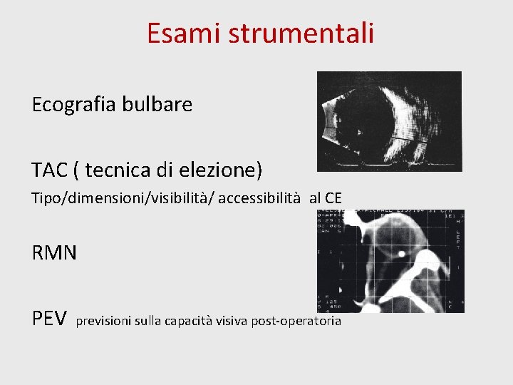 Esami strumentali Ecografia bulbare TAC ( tecnica di elezione) Tipo/dimensioni/visibilità/ accessibilità al CE RMN