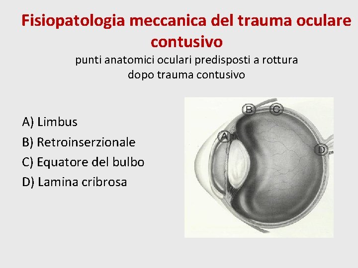 Fisiopatologia meccanica del trauma oculare contusivo punti anatomici oculari predisposti a rottura dopo trauma