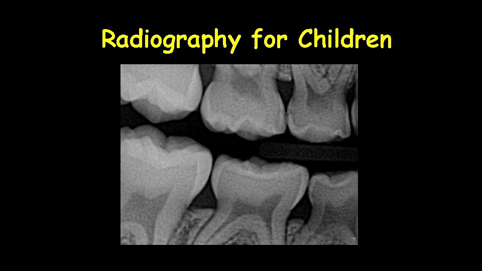 Radiography for Children 