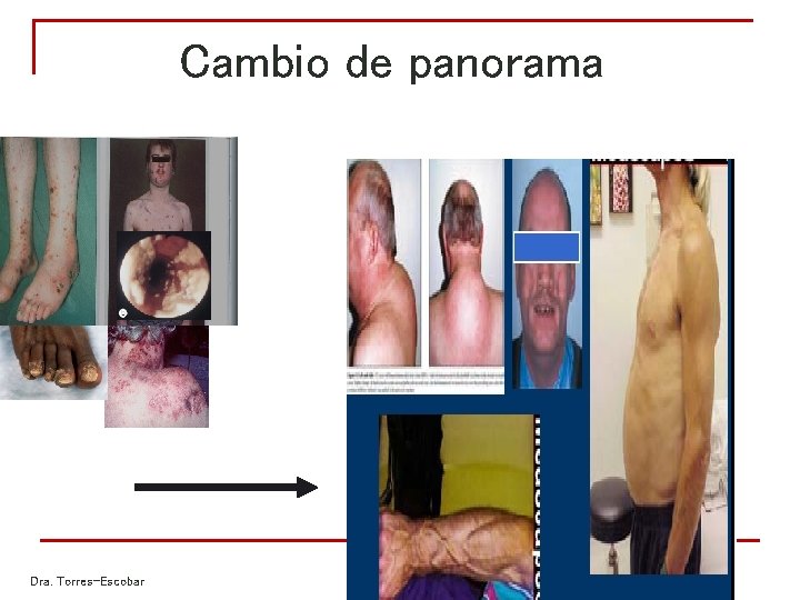 Cambio de panorama Dra. Torres-Escobar Cambio de panorama Dra. Torres-Escobar