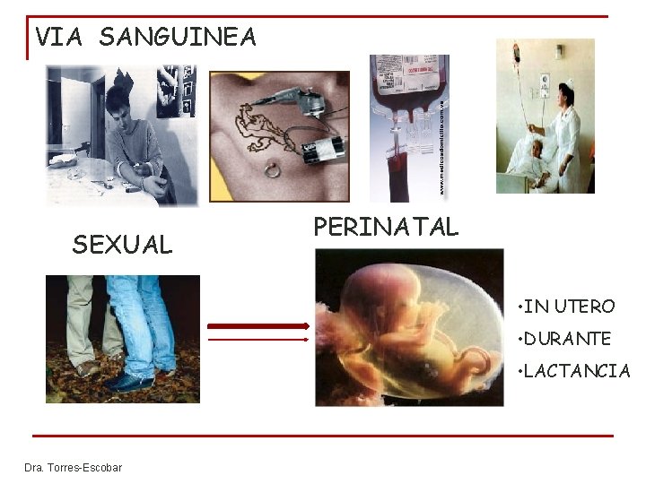 VIA SANGUINEA SEXUAL PERINATAL • IN UTERO • DURANTE • LACTANCIA Dra. Torres-Escobar VIA SANGUINEA SEXUAL PERINATAL • IN UTERO • DURANTE • LACTANCIA Dra. Torres-Escobar